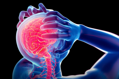 Epilepsi: Epilepsi belirtileri nelerdir?  Epilepsi hastalığı nasıl başlar?