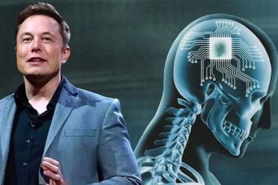 Neuralink: 'Kafatasındaki işlemci ve pilin sinirlerden aldığı veri miktarı azaldı'