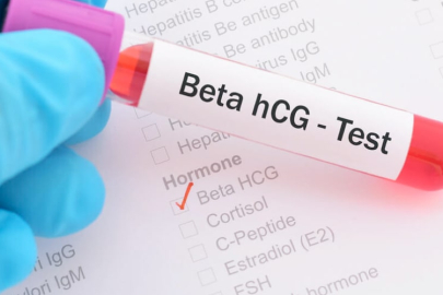 Beta HCG nedir, ne değildir?